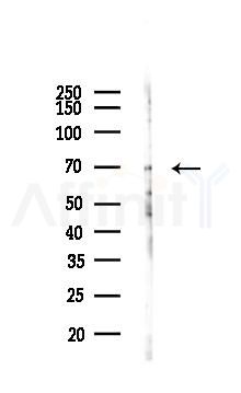 PPAR gamma Antibody - Western blot analysis of lysates from B16F10-LUC cells(LPS 4h treatment), using PPAR gamma Antibody at 1/1000 dilution.