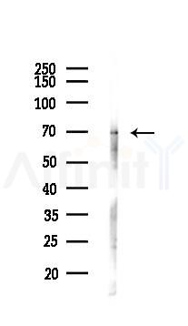 PPAR gamma Antibody - Western blot analysis of lysates from HUVEC cells(LPS 4h treatment), using PPAR gamma Antibody at 1/1000 dilution.