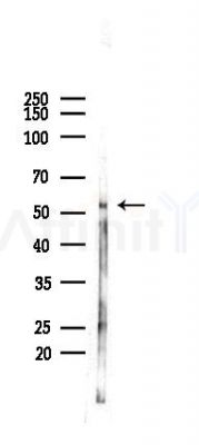 PPAR gamma Antibody - Western blot analysis of lysates from Rat lung, using PPAR gamma Antibody at 1/1000 dilution.