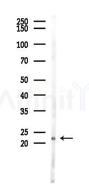 p21 Cip1 Antibody - Western blot analysis of lysates from Rat muscle, using p21 Cip1 Antibody at 1/1000 dilution.