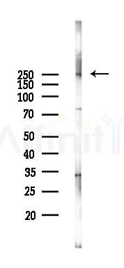 mTOR Antibody - Western blot analysis of lysates from Hela cells(LPS 4h treatment), using mTOR Antibody at 1/1000 dilution.