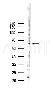 RelB Antibody - Western blot analysis of lysates from 293 cells(LPS 4h treatment), using RelB Antibody at 1/1000 dilution.