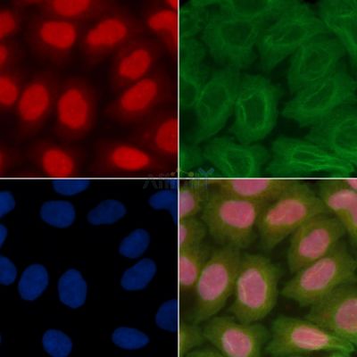 BCL-XL Antibody - AF6415 staining Hela cells(30min of UV treatment) by IF/ICC.