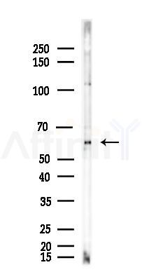 AMPK alpha Antibody - Western blot analysis of lysates from HUVEC cells(LPS 4h treatment), using AMPK alpha Antibody at 1/1000 dilution.