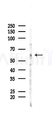 AMPK alpha Antibody - Western blot analysis of lysates from COLO205 cells(heat-shock 45min treatment), using AMPK alpha Antibody at 1/1000 dilution.