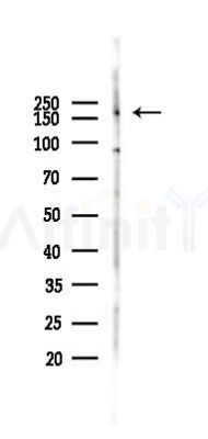TRAP220/MED1 Antibody - Western blot analysis of lysates from 293 cells(LPS 4h treatment), using TRAP220/MED1 Antibody at 1/1000 dilution.