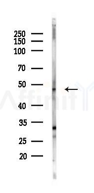 IKB beta Antibody - Western blot analysis of lysates from Hela cells(heat-shock 24h treatment), using IKB beta Antibody at 1/1000 dilution.