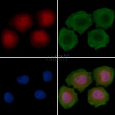 HDAC8 Antibody - AF6481 staining Hela cells(30min of UV treatment) by IF/ICC.