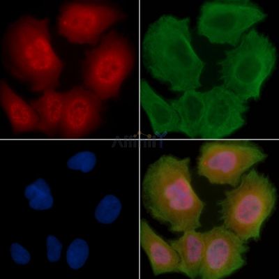 PBK/TOPK Antibody - AF6556 staining Hela cells(30min of UV treatment) by IF/ICC.