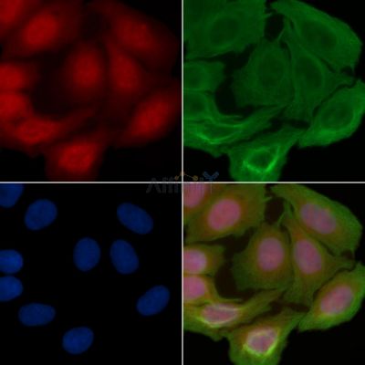 Optineurin Antibody - AF6560 staining Hela cells(30min of UV treatment) by IF/ICC.