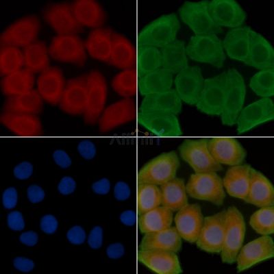 BLNK Antibody - AF6566 staining Hela cells(30min of UV treatment) by IF/ICC.