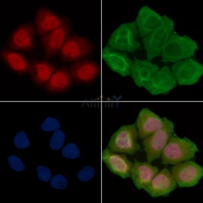 SIRT6 Antibody - AF6569 staining Hela cells(30min of UV treatment) by IF/ICC.