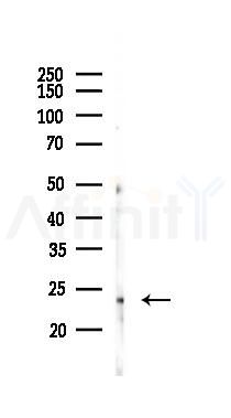 RAB7L1 Antibody - Western blot analysis of lysates from Mouse brain, using RAB7L1 Antibody at 1/1000 dilution.