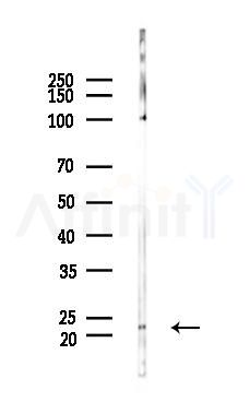 BID Antibody - Western blot analysis of lysates from Mouse muscle, using BID Antibody at 1/1000 dilution.