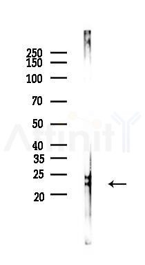 BID Antibody - Western blot analysis of lysates from Rat testis, using BID Antibody at 1/1000 dilution.