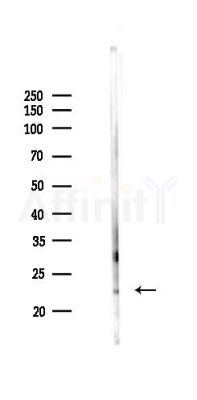 TIMP1 Antibody - Western blot analysis of lysates from Mouse kidney, using TIMP1 Antibody at 1/1000 dilution.
