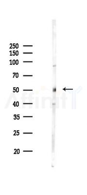 Vimentin Antibody - Western blot analysis of lysates from Rat testis, using Vimentin Antibody at 1/1000 dilution.