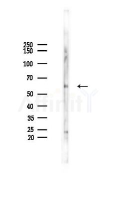 Vimentin Antibody - Western blot analysis of lysates from A2780 cells(LPS 4h treatment), using Vimentin Antibody at 1/1000 dilution.
