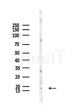 TNF alpha Antibody - Western blot analysis of lysates from Rat testis, using TNF alpha Antibody at 1/1000 dilution.
