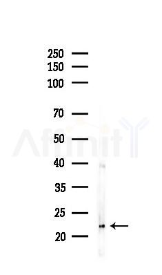 TNF alpha Antibody - Western blot analysis of lysates from HepG2 cells(heat-shock 45min treatment), using TNF alpha Antibody at 1/1000 dilution.