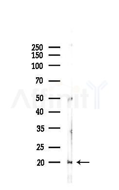TNF alpha Antibody - Western blot analysis of lysates from Mouse lung, using TNF alpha Antibody at 1/1000 dilution.