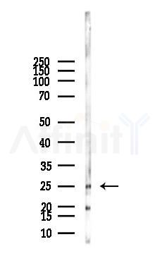 TNF alpha Antibody - Western blot analysis of lysates from Mouse kidney, using TNF alpha Antibody at 1/1000 dilution.