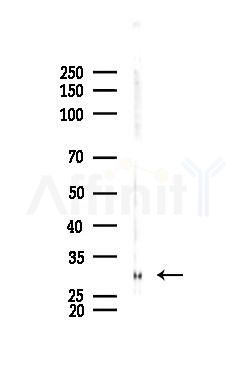 TNF alpha Antibody - Western blot analysis of lysates from PC12 cells(UV 30min treatment), using TNF alpha Antibody at 1/1000 dilution.