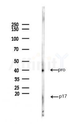 Cleaved-Caspase 3 (Asp175), p17 Antibody - Western blot analysis of lysates from Mouse kidney, using Cleaved-Caspase 3 (Asp175), p17 Antibody at 1/1000 dilution.