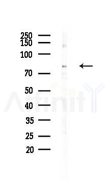 Phospho-FMR1 (Ser500) Antibody - Western blot analysis of lysates from HUVEC cells(heat-shock 45min treatment), using Phospho-FMR1 (Ser500) Antibody at 1/1000 dilution.