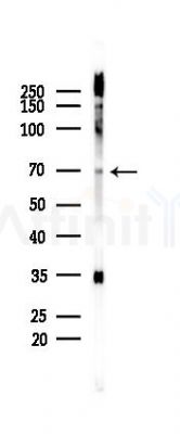 Phospho-TRIM32 (Ser339) Antibody - Western blot analysis of lysates from 293 cells(starvation 24h treatment), using Phospho-TRIM32 (Ser339) Antibody at 1/1000 dilution.