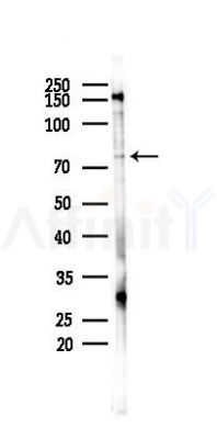 Phospho-TRIM32 (Ser339) Antibody - Western blot analysis of lysates from PC12 cells(starvation 24h treatment), using Phospho-TRIM32 (Ser339) Antibody at 1/1000 dilution.