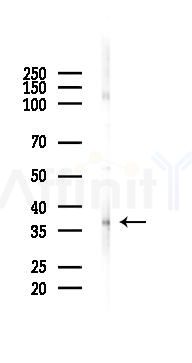 Phospho-Annexin IV (Tyr255) Antibody - Western blot analysis of lysates from HUVEC cells(UV 30min treatment), using Phospho-Annexin IV (Tyr255) Antibody at 1/1000 dilution.