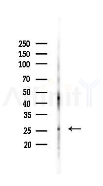 Phospho-CDC34 (Ser71) Antibody - Western blot analysis of lysates from Mouse testis, using Phospho-CDC34 (Ser71) Antibody at 1/1000 dilution.