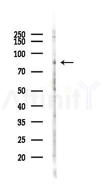 Phospho-CTNNAL1 (Tyr436) Antibody - Western blot analysis of lysates from K562 cells(UV 30min treatment), using Phospho-CTNNAL1 (Tyr436) Antibody at 1/1000 dilution.