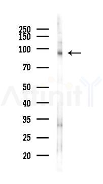 Phospho-ARHGAP42 (Tyr792) Antibody - Western blot analysis of lysates from K562 cells(UV 30min treatment), using Phospho-ARHGAP42 (Tyr792) Antibody at 1/1000 dilution.