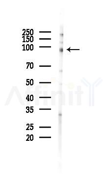 Phospho-MuSK (Tyr751) Antibody - Western blot analysis of lysates from HUVEC cells(UV 30min treatment), using Phospho-MuSK (Tyr751) Antibody at 1/1000 dilution.
