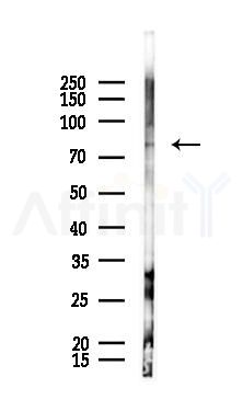 Phospho-TAK1 (Ser192) Antibody - Western blot analysis of lysates from PC12 cells(UV 30min treatment), using Phospho-TAK1 (Ser192) Antibody at 1/1000 dilution.