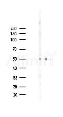 Phospho-Lck (Tyr505) Antibody - Western blot analysis of lysates from COLO205 cells(heat-shock 45min treatment), using Phospho-Lck (Tyr505) Antibody at 1/1000 dilution.