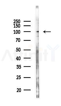 Phospho-ADRB2 (Thr68) Antibody - Western blot analysis of lysates from 293 cells(heat-shock 45min treatment), using Phospho-ADRB2 (Thr68) Antibody at 1/1000 dilution.