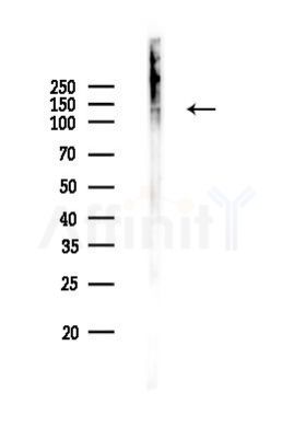 Phospho-E-cadherin (Tyr754) Antibody - Western blot analysis of lysates from Rat lung, using Phospho-E-cadherin (Tyr754) Antibody at 1/1000 dilution.