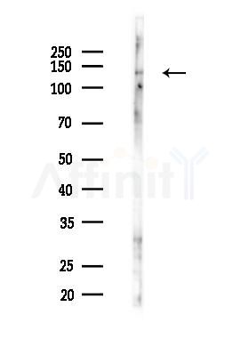 Phospho-CFTR (Thr1471) Antibody - Western blot analysis of lysates from PC12 cells(starvation 24h treatment), using Phospho-CFTR (Thr1471) Antibody at 1/1000 dilution.