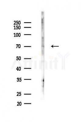 Phospho-Plastin L (Tyr300) Antibody - Western blot analysis of lysates from PC12 cells(starvation 24h treatment), using Phospho-Plastin L (Tyr300) Antibody at 1/1000 dilution.