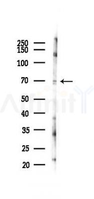 Phospho-Synapsin I (Ser427) Antibody - Western blot analysis of lysates from 293 cells(UV 30min treatment), using Phospho-Synapsin I (Ser427) Antibody at 1/1000 dilution.