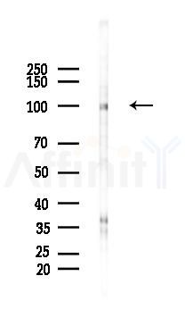 Phospho-CBL (Ser804) Antibody - Western blot analysis of lysates from Hela cells(starvation 24h treatment), using Phospho-CBL (Ser804) Antibody at 1/1000 dilution.