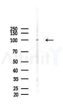 Phospho-CBL (Ser804) Antibody - Western blot analysis of lysates from PC12 cells(UV 30min treatment), using Phospho-CBL (Ser804) Antibody at 1/1000 dilution.