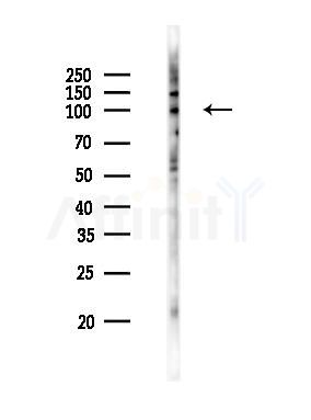 Phospho-GluR1 (Ser836) Antibody - Western blot analysis of lysates from Rat lung, using Phospho-GluR1 (Ser836) Antibody at 1/1000 dilution.
