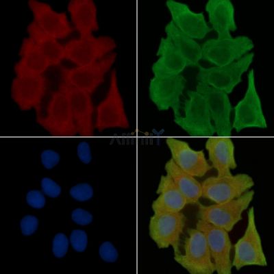 Phospho-PYK2 (Tyr579/Tyr580) Antibody - AF7383 staining Hela cells(30min of UV treatment) by IF/ICC.