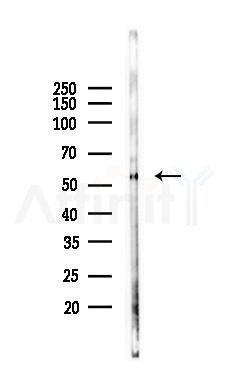 Phospho-Beclin 1 (Ser90/Ser93/Ser96) Antibody - Western blot analysis of lysates from Rat kidney, using Phospho-Beclin 1 (Ser90/Ser93/Ser96) Antibody at 1/1000 dilution.