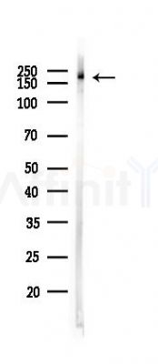 Phospho-NCoA2 (Ser698/Ser699) Antibody - Western blot analysis of lysates from Mouse brain, using Phospho-NCoA2 (Ser698/Ser699) Antibody at 1/1000 dilution.