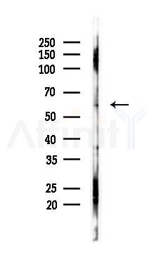 Phospho-GRK1 (Ser21) Antibody - Western blot analysis of lysates from B16F10-LUC cells(UV 30min treatment), using Phospho-GRK1 (Ser21) Antibody at 1/1000 dilution.